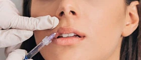 Harmonização Orofacial