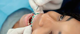 Ortodontia com Capacitação em Alinhadores