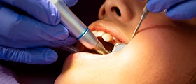 Cirurgia Periodontal e Bucal