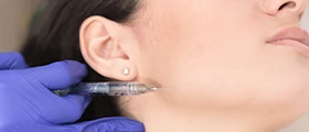 Harmonização Orofacial