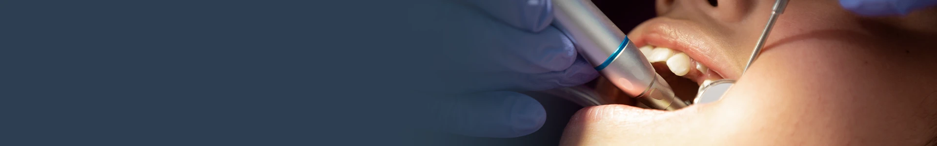 Cirurgia Periodontal e Bucal
