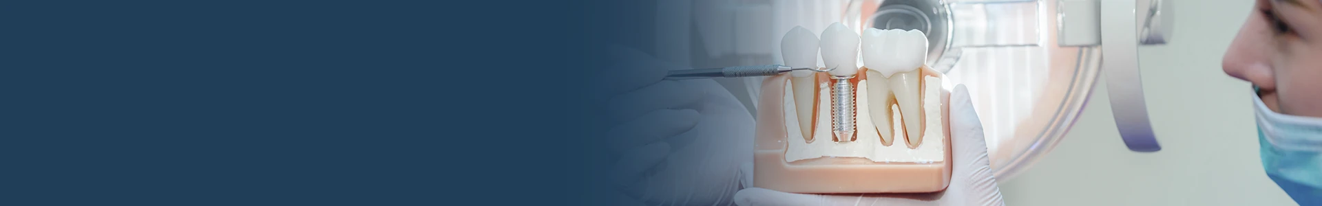 Day Clinical – Implantodontia / Casos complexos