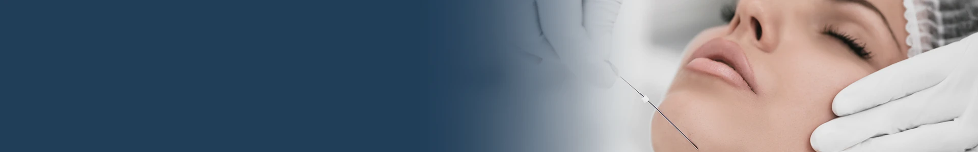 Day Clinical HOF – Fios de PDO