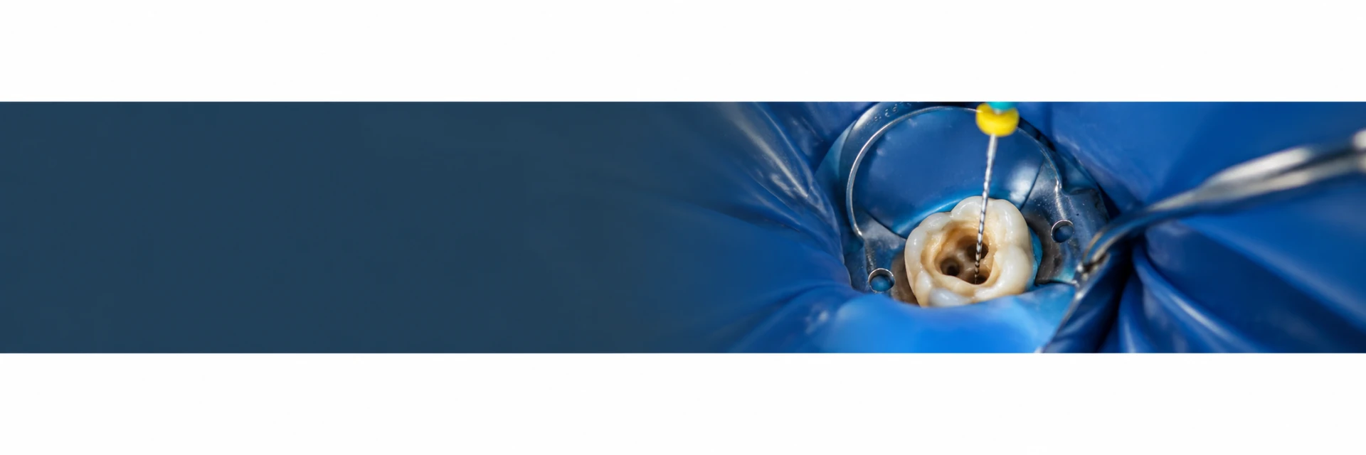 Endodontia com Habilitação em Laserterapia